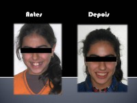 /album/casos-clinicos1/a156394-479276395453458-309790948-n-jpg2/